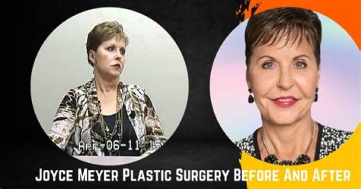 The Joyce Meyer Facelift Unveiled
